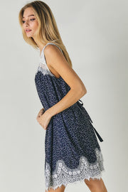 TBYB! Printed Sleeveless Lace Trim Mini Dress (S, M, L)